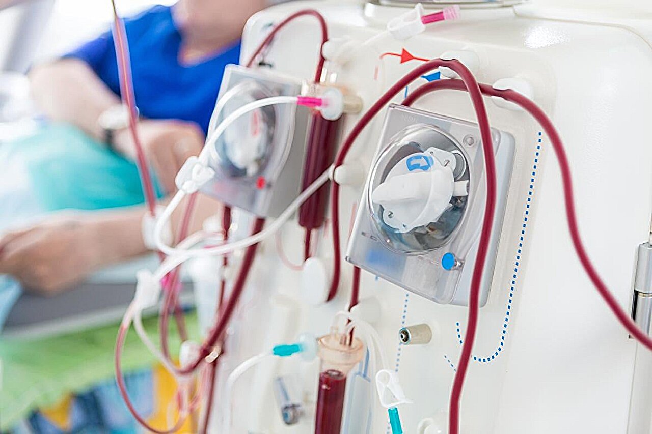 Nustatyta, kad denosumabas padidina širdies ir kraujagyslių ligų riziką pacientams, kuriems taikoma dializė