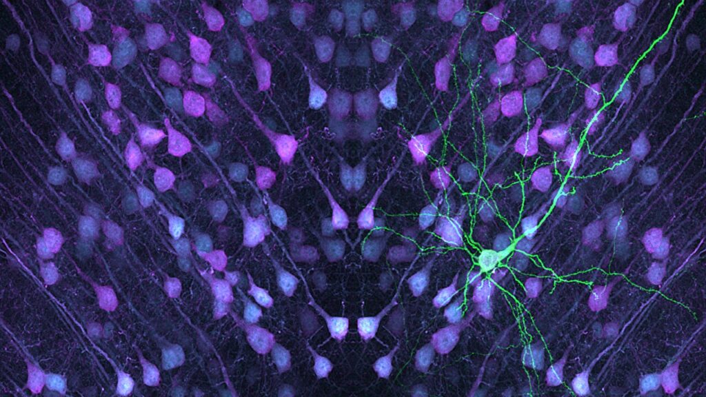 Tyrimai atskleidžia unikalias smegenų ląstelių savybes, susijusias su neurologinio vystymosi sąlygomis