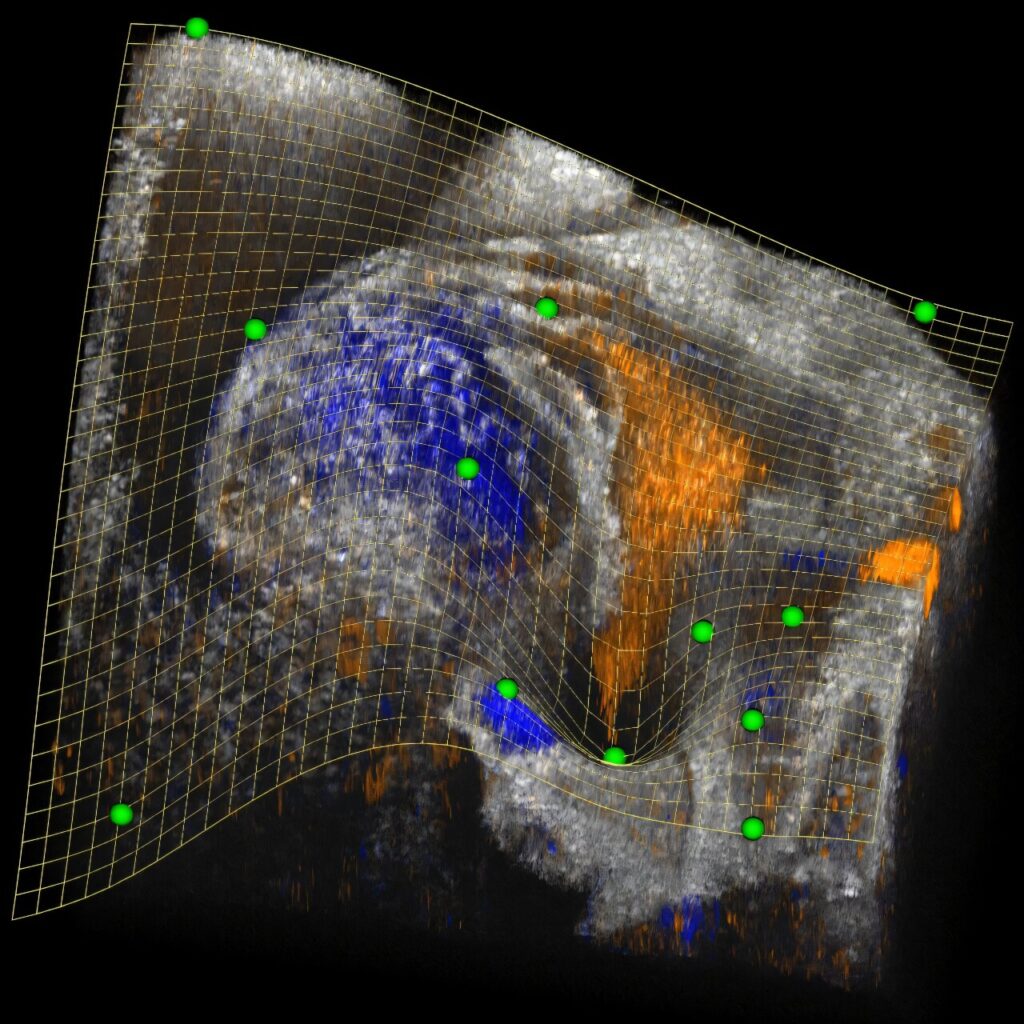 Programinės įrangos įrankis suteikia naują sudėtingų 3D biomedicininių vaizdų vaizdą