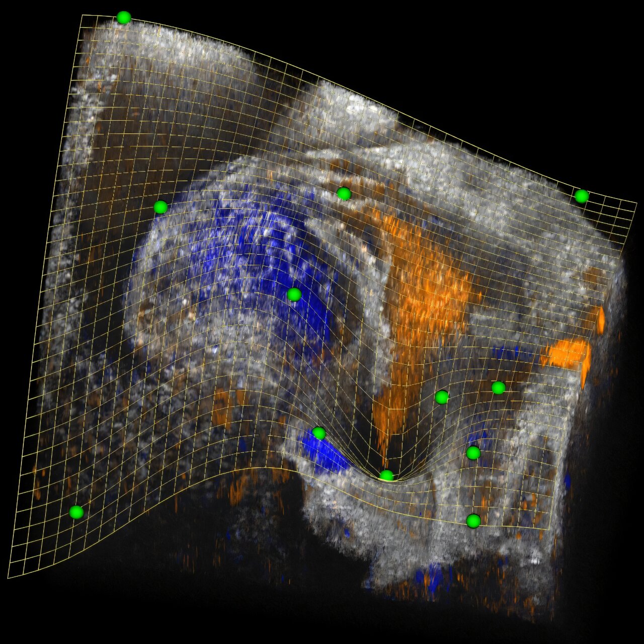 Programinės įrangos įrankis suteikia naują sudėtingų 3D biomedicininių vaizdų vaizdą