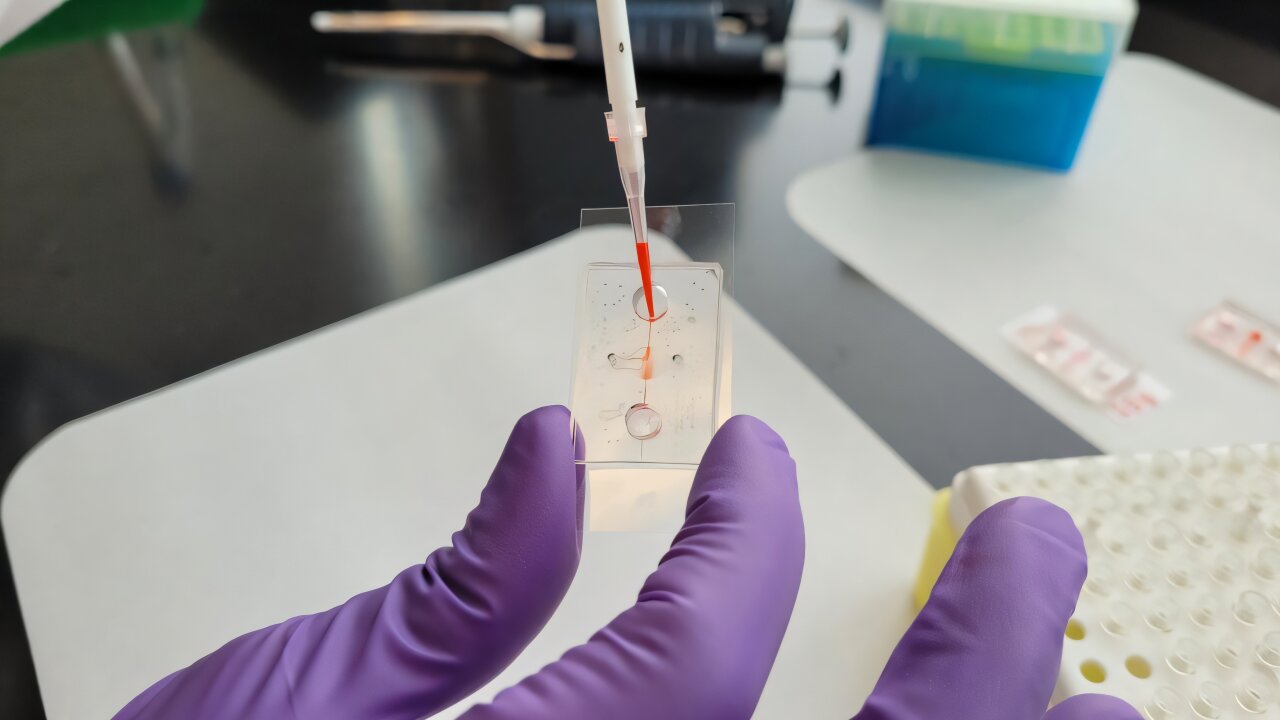 Kraujagyslės ant lusto nustato, kaip perivaskulinės ląstelės gali pabloginti lėtinę ligą
