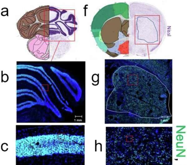 Santykinė neuronų ir glijos dalis skirtinguose smegenų regionuose skiriasi. Autoriai: Nature Communications (2024). DOI: 10.1038/s41467-024-51906-5 DNR pažeidimo smegenyse paslapčių išaiškinimas