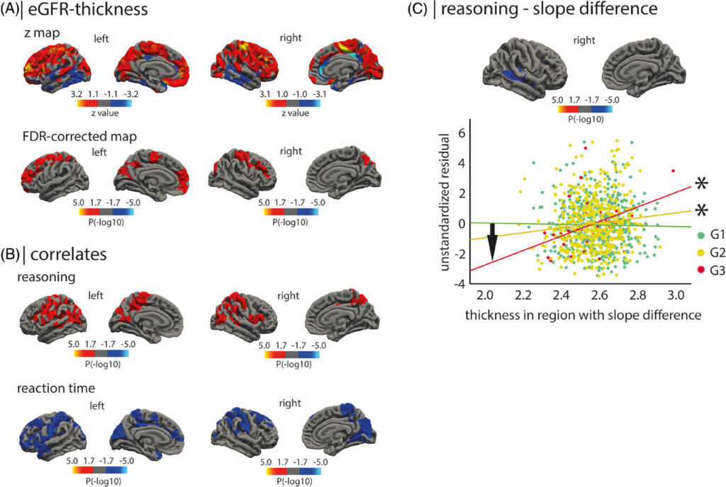 Lėtinė inkstų liga, susijusi su smegenų atrofija, galima Alzheimerio ligos rizika