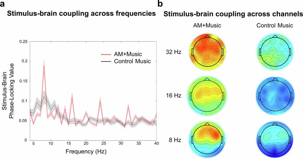 Muzika gali pagerinti ADHD turinčių žmonių dėmesį – štai ko klausytis