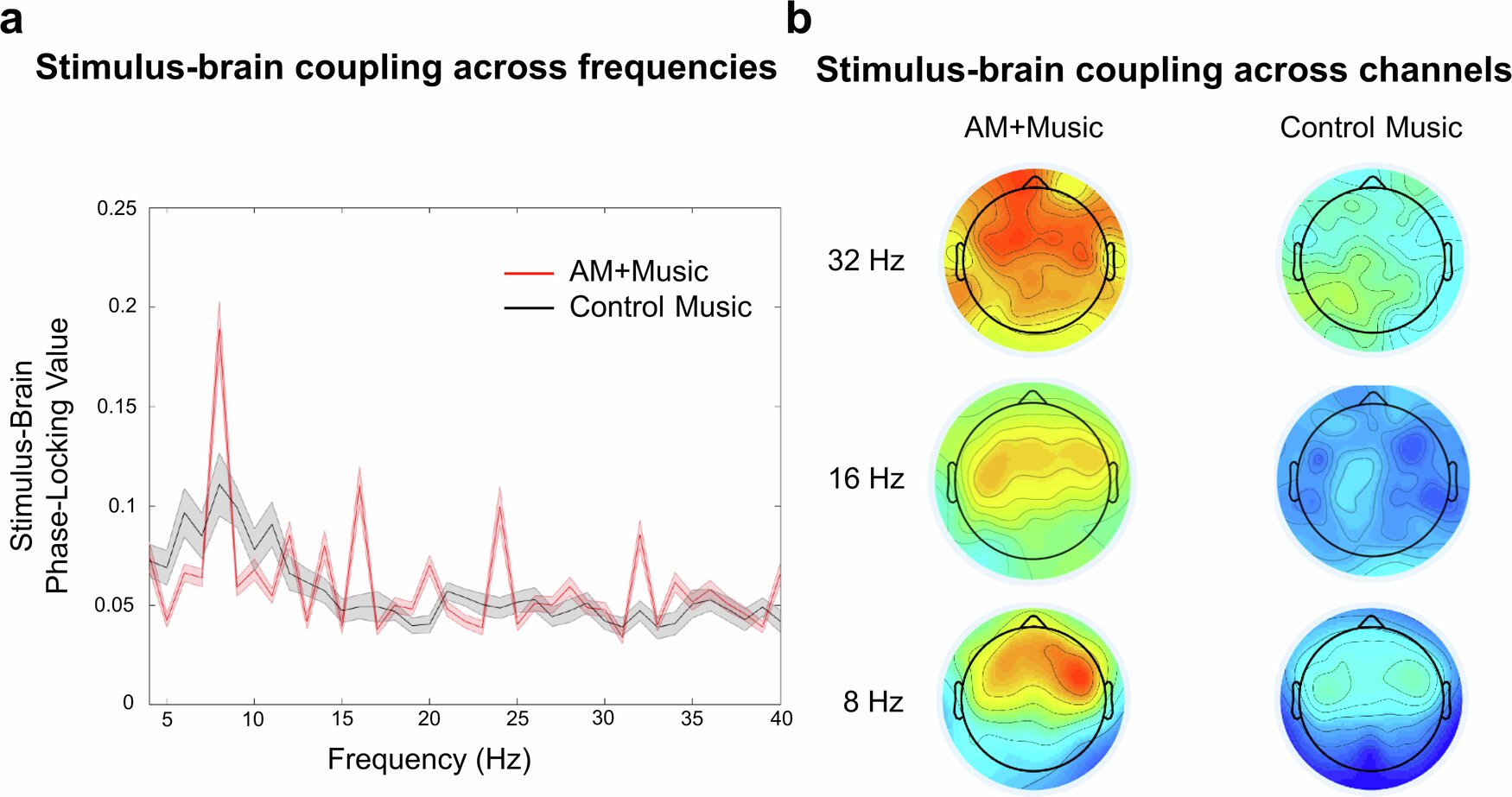 Muzika gali pagerinti ADHD turinčių žmonių dėmesį – štai ko klausytis