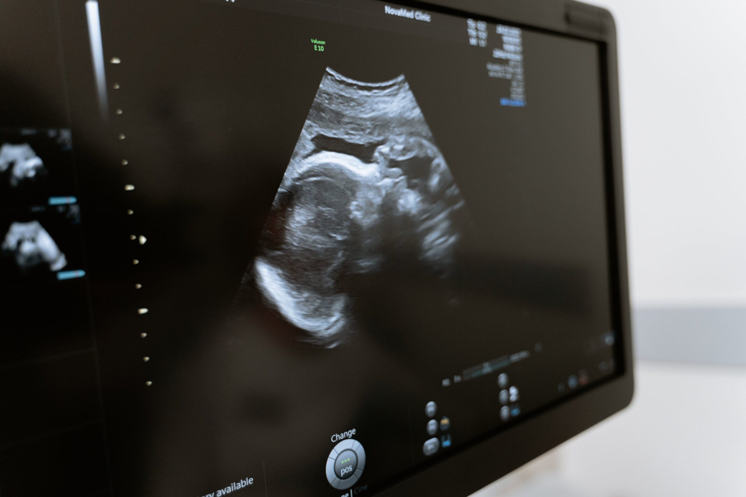 Pažangūs genetiniai tyrimai suteikia naujų vilčių sveikai pradėti gyvenimą