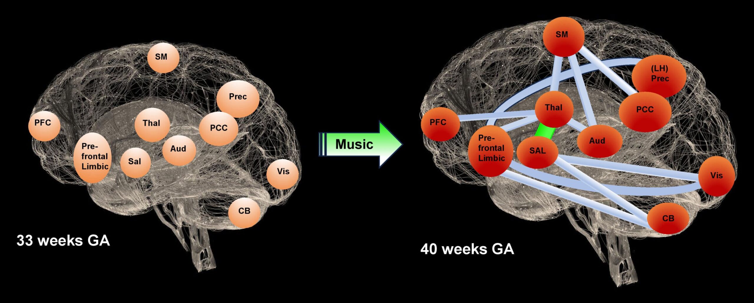 Muzika palaiko kūdikius naujagimių intensyviosios terapijos skyriuose, rodo neurovaizdinės studijos