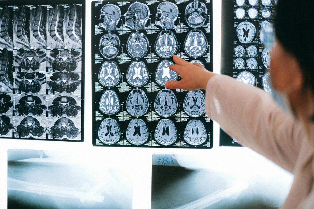 Microglia rodo specifinius lyties atsakus, kurie gali turėti platų poveikį neurologinių ligų tyrimams
