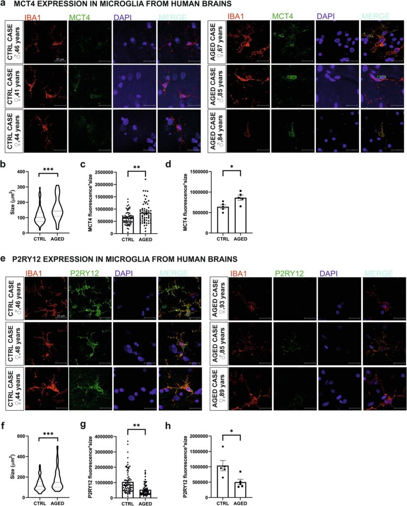 Senstančios smegenų ląstelių mikroglijos, susijusios su neurologiniais sutrikimais