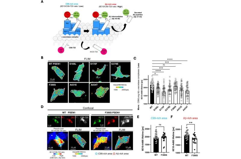 FAD mutantas PS1 stabilizuoja γ-sekretazės ES sąveiką. Kreditas: eLife (2025). DOI: 10.7554/eLife.102274.2 Tyrimas rodo, kad sustojusi amiloido baltymų gamyba skatina Alzheimerio ligą