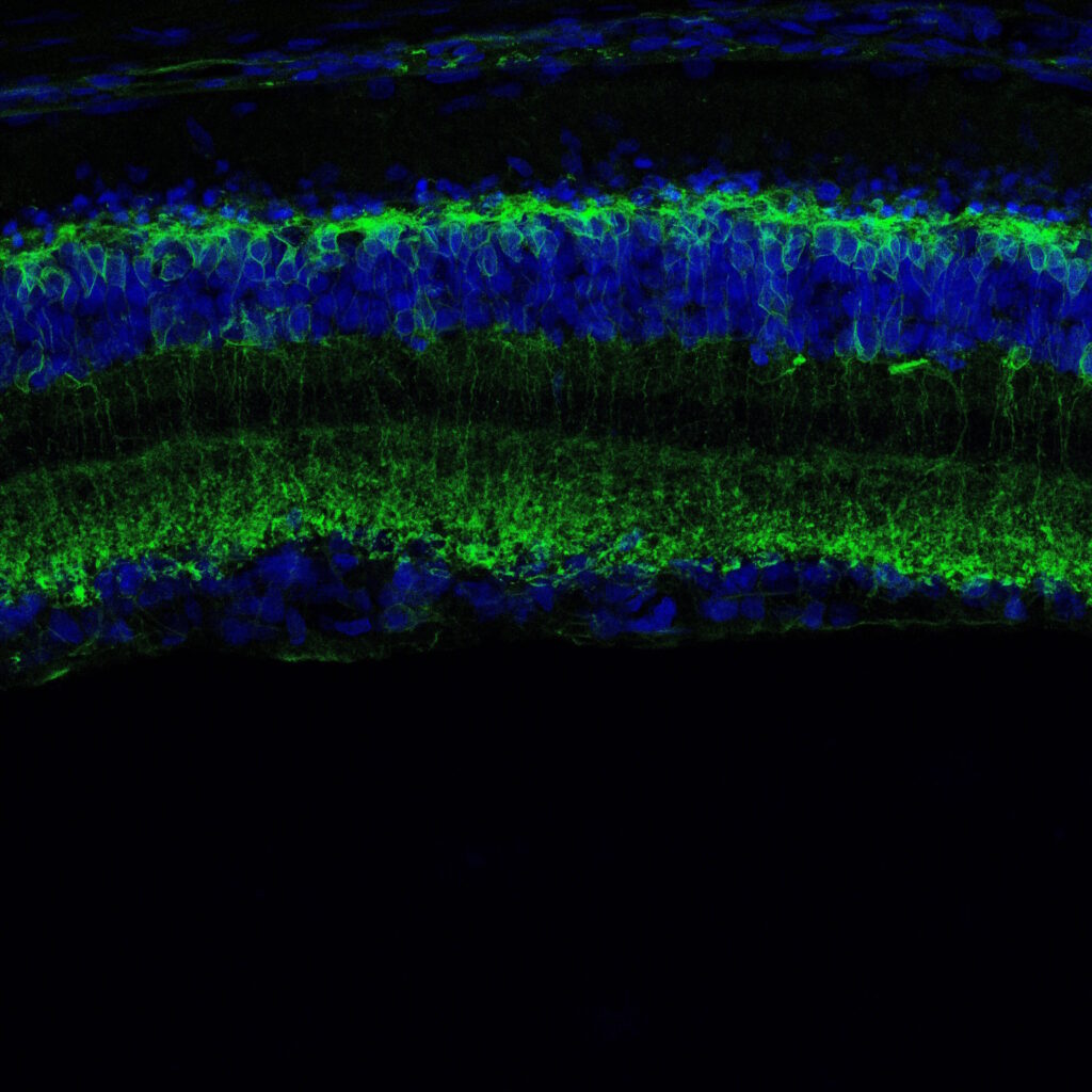 Ziapin2 veiksmingai atkuria tinklainės funkciją ikiklinikiniuose pigmentinio retinito ir geltonosios dėmės degeneracijos modeliuose
