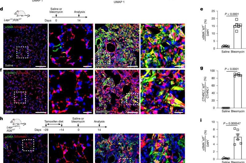 LEPR ekspresuojančios plaučių mezenchiminės ląstelės sukelia patologinius fibroblastus plaučių fibrozės metu. Kreditas: Gamta (2025). Doi: 10.1038/s41586-024-08542-2 Rastas: ląstelių šaltinis, prisidedantis prie plaučių fibrozės
