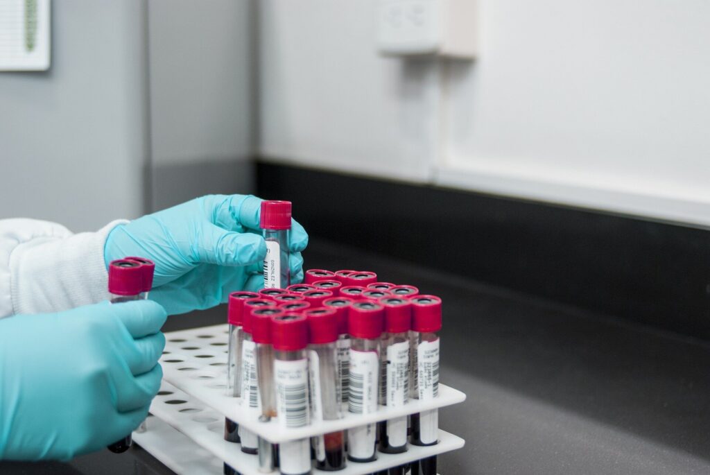 Kraujo tyrimas supaprastina invazinių pelėsių infekcijų diagnozę