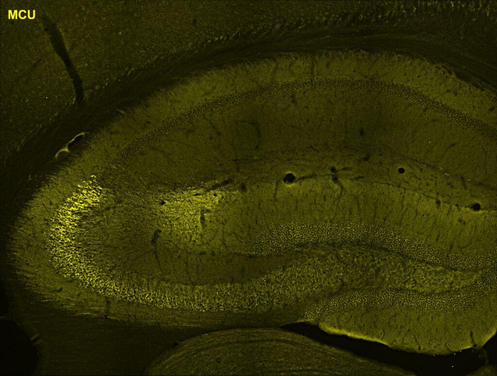 Mokslininkai atranda mitochondrijų vaidmenį formuojant atminties grandines