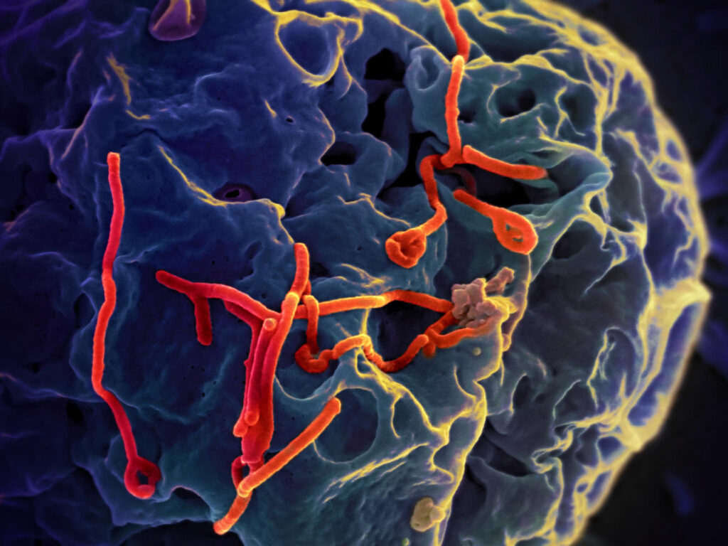 Laboratorijos laikymas Ebola KDR Goma „Saugi“: kas