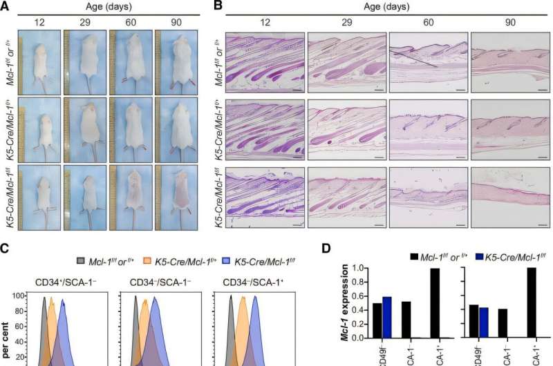 MCL-1 ištrynimas pašalina aktyvias plaukų folikulo kamienines ląsteles ir sustabdo plaukų augimą. Kreditas: „Nature Communications“ (2025). Doi: 10.1038/s41467-025-58150-5 Naujas tyrimas atskleidžia apsaugos baltymą, kuris palaiko suaugusiųjų plaukų augimą