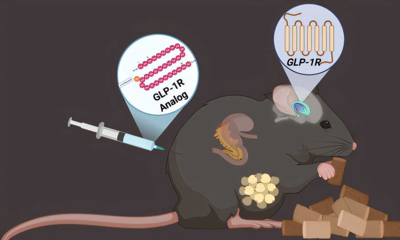 GLP-1 terapijos rodo potencialą gydyti retą genetinį sutrikimą Bardet-Biedl sindromą