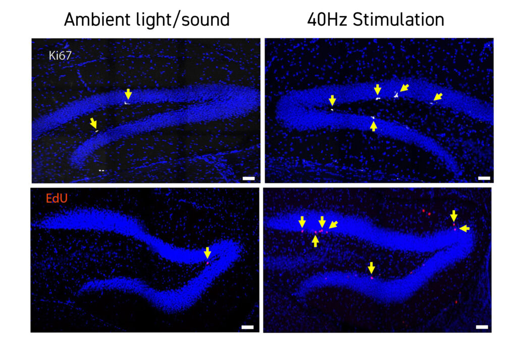 Dauno sindromo pelėms 40Hz šviesa ir garsas pagerina pažinimą, neurogenezę ir ryšį