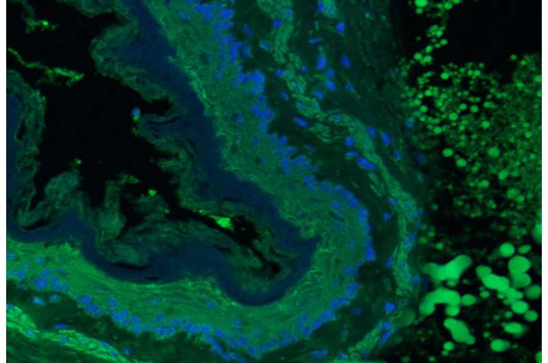 Geriau nei dygsniai, tyrėjai sukuria biologiškai suderinamą pleistrą, kad būtų galima sužaloti minkštus organus