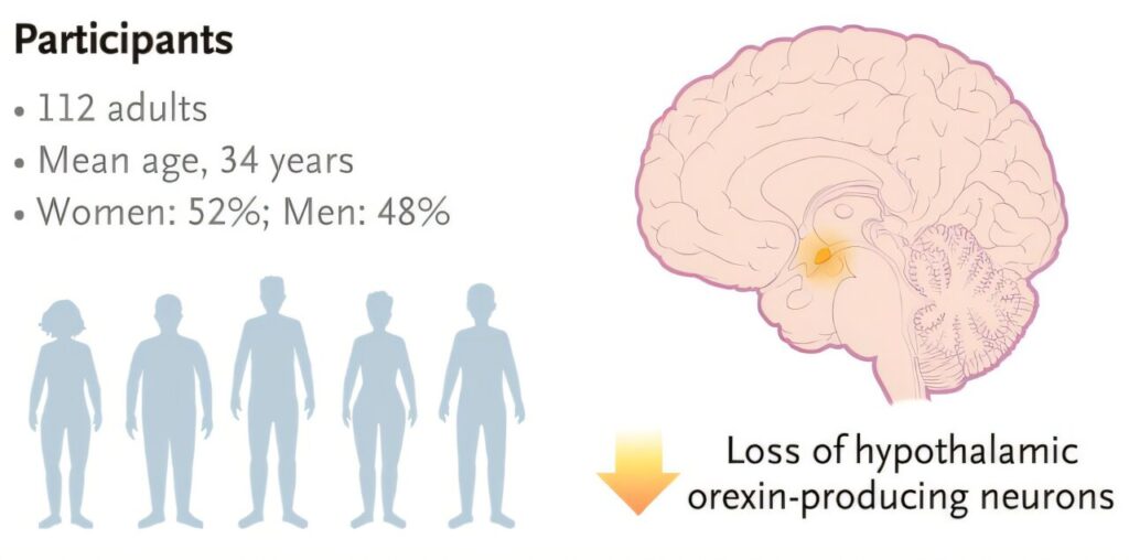 „OvePorexton“ rodo pažadą pagerinti pabudimą Narcolepsy 1 tipo