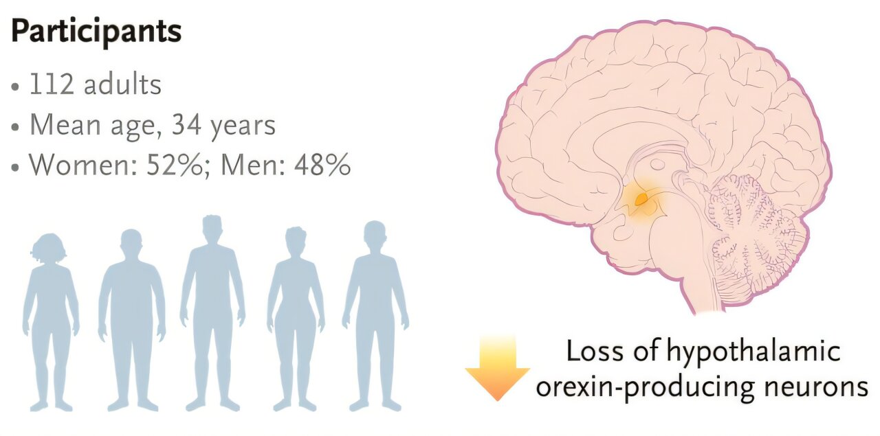 „OvePorexton“ rodo pažadą pagerinti pabudimą Narcolepsy 1 tipo
