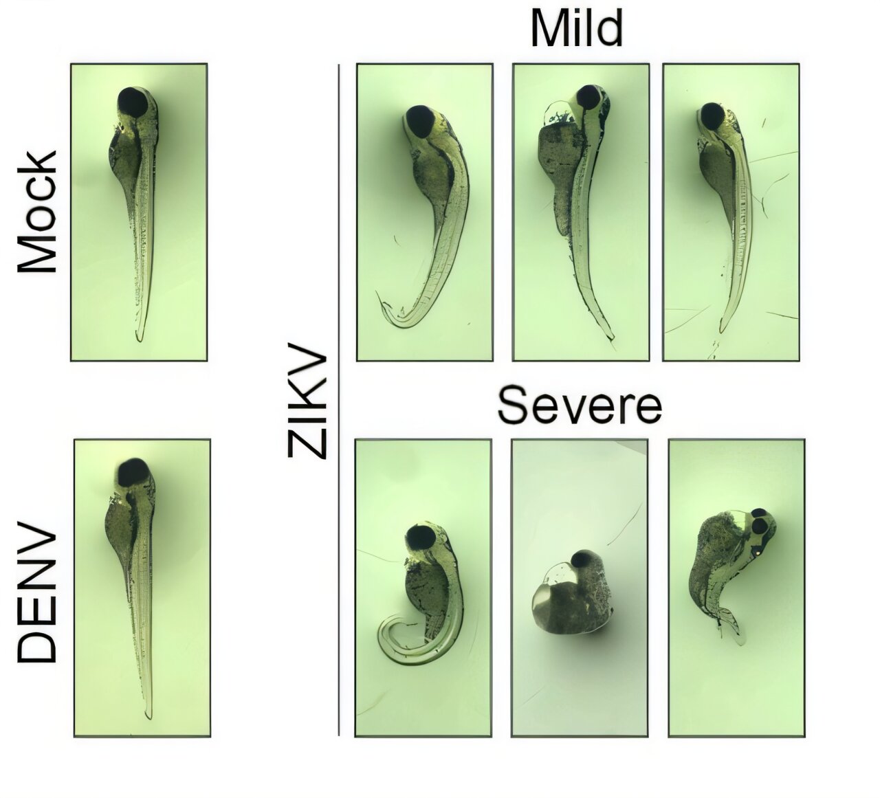 Zebrafish modelis parodo, kaip Zikos virusas sutrikdo ankstyvą smegenų vystymąsi