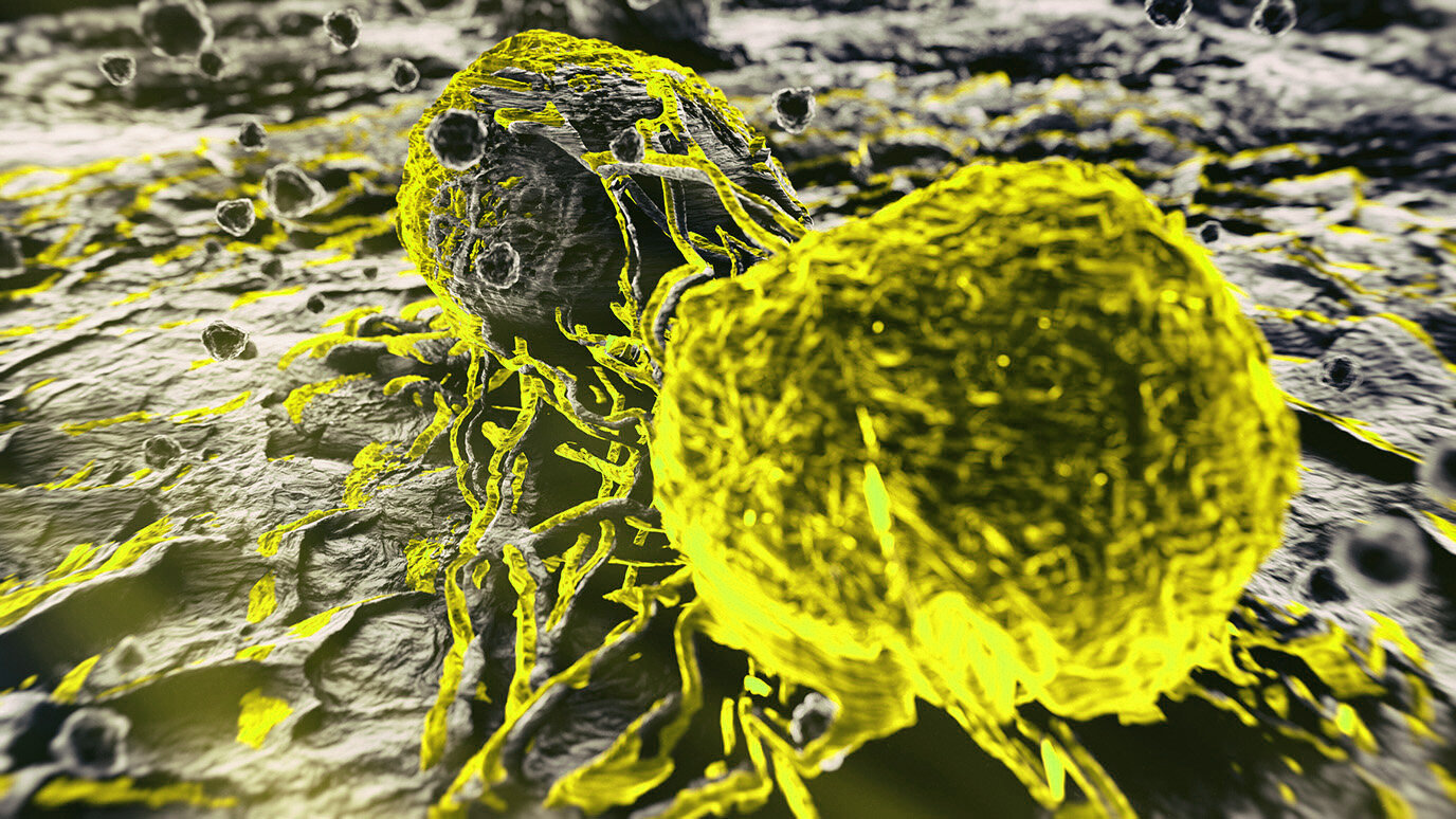 Naujas biomarkeris gali padėti geriausiai naudoti KRAS inhibitorius plaučių vėžyje