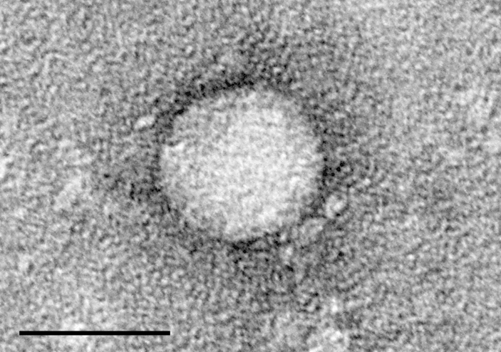 Įperkamos priežiūros įstatymas Prevencinių paslaugų mandatas Raktas pertvarkyti hepatito C gydymą