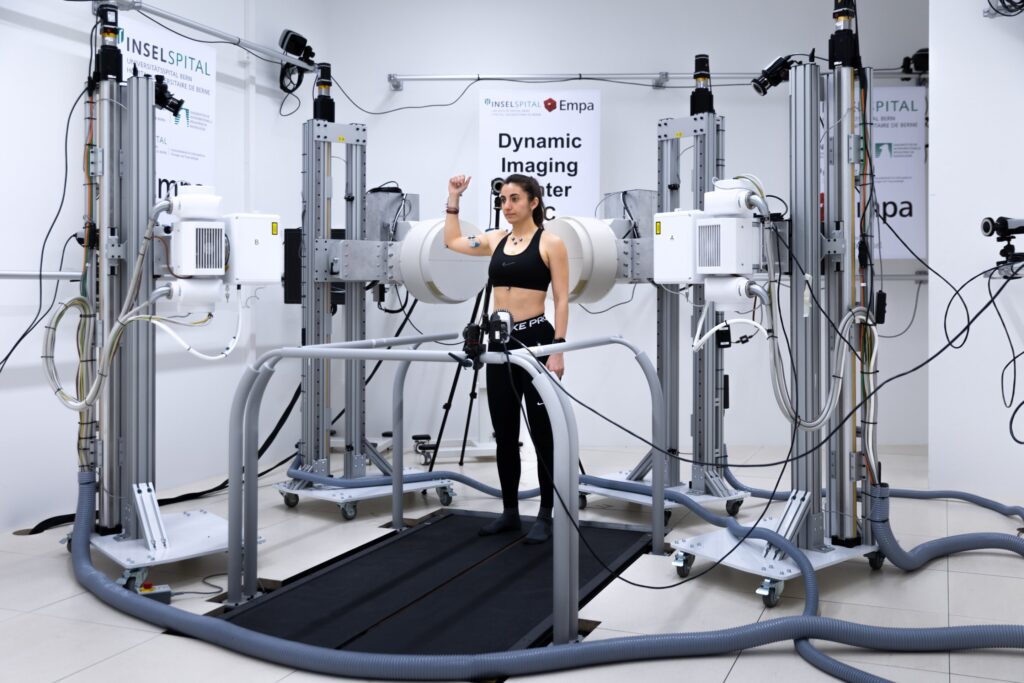 Dinaminė 3D diagnozė nestabiliems pečiams