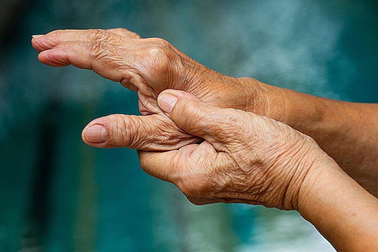 Ilgalaikio įprastinio laboratorinio vaisto toksiškumo nauda neaišku reumatoidinio artrito metu