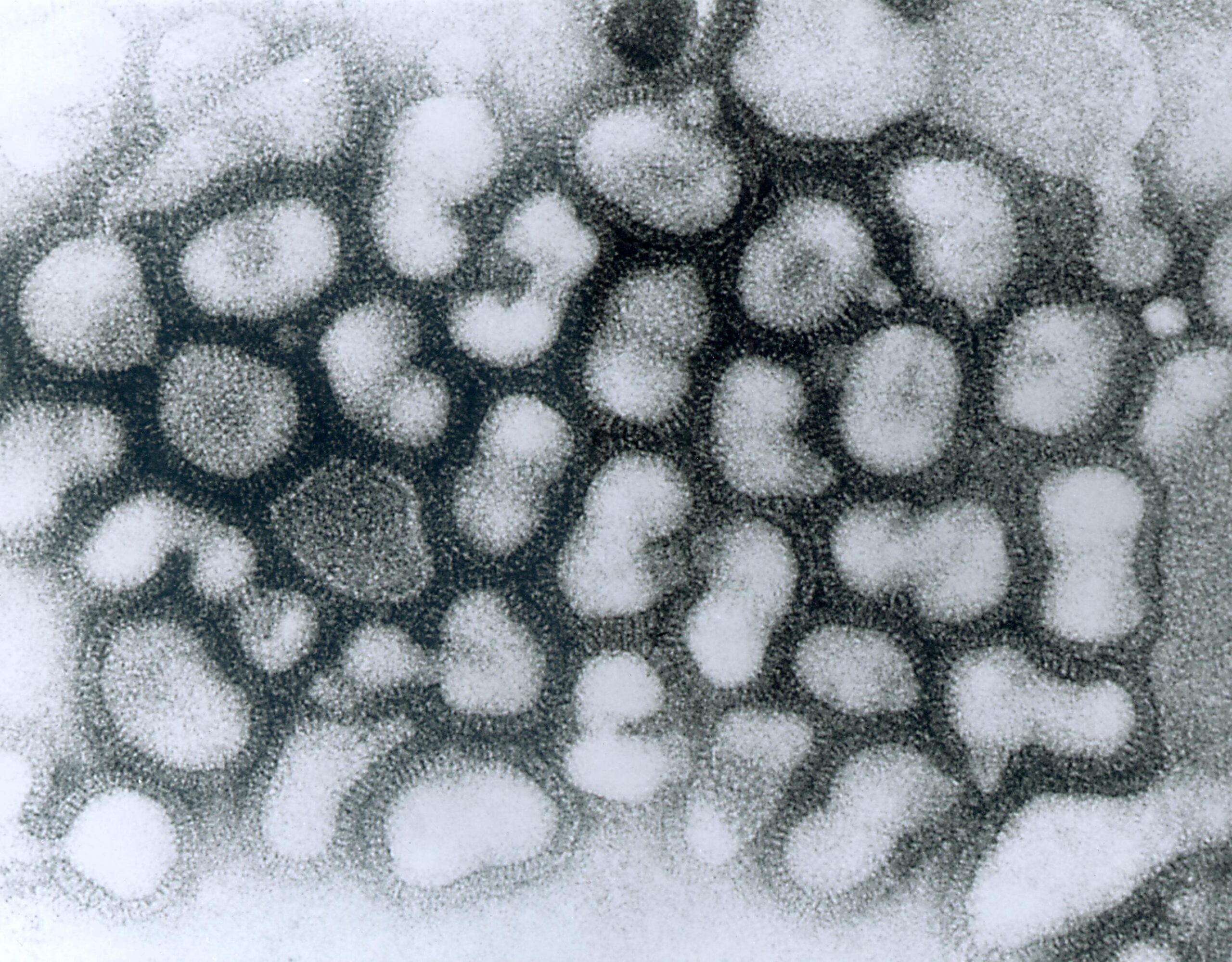 Naujas antikūnų kokteilis rodo pažadą gydyti kelis gripo padermes