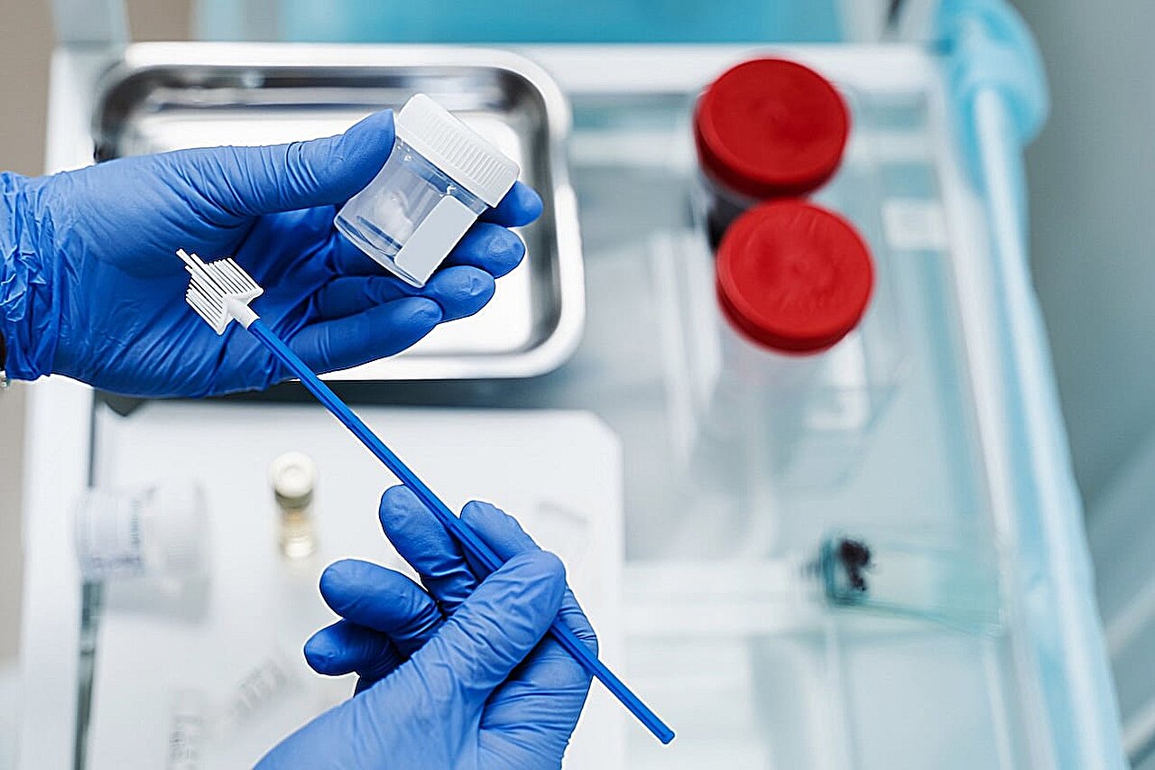 Neapdorojimas gimdos kaklelio vėžio patikrinimui padidėjo po Covidid-19 pandemijos