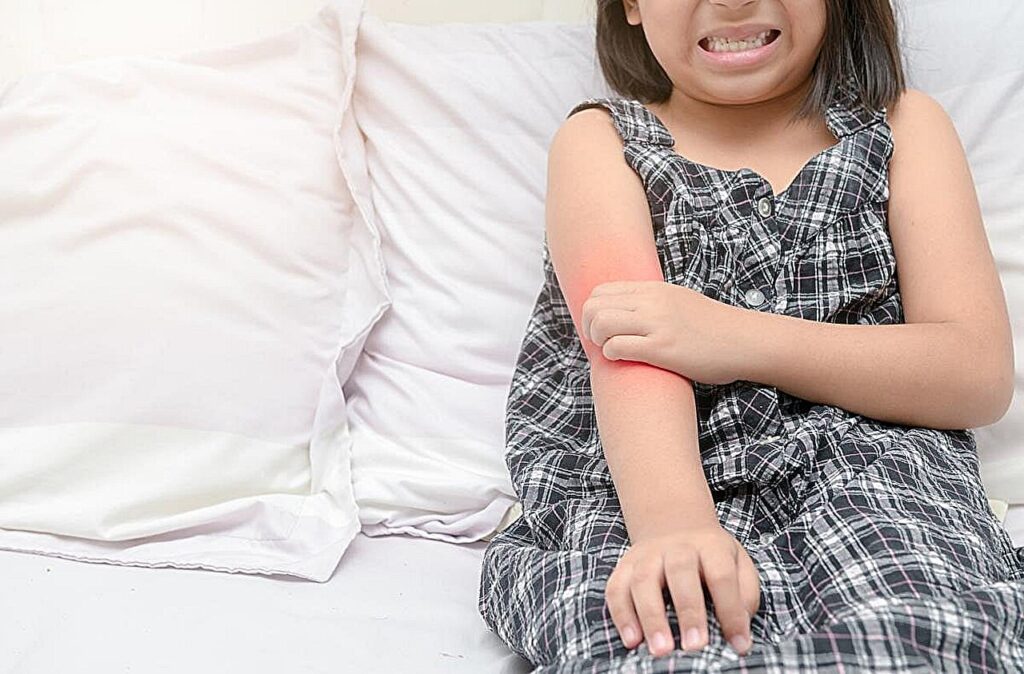 FDA patvirtina opzelura dėl atopinio dermatito vaikams