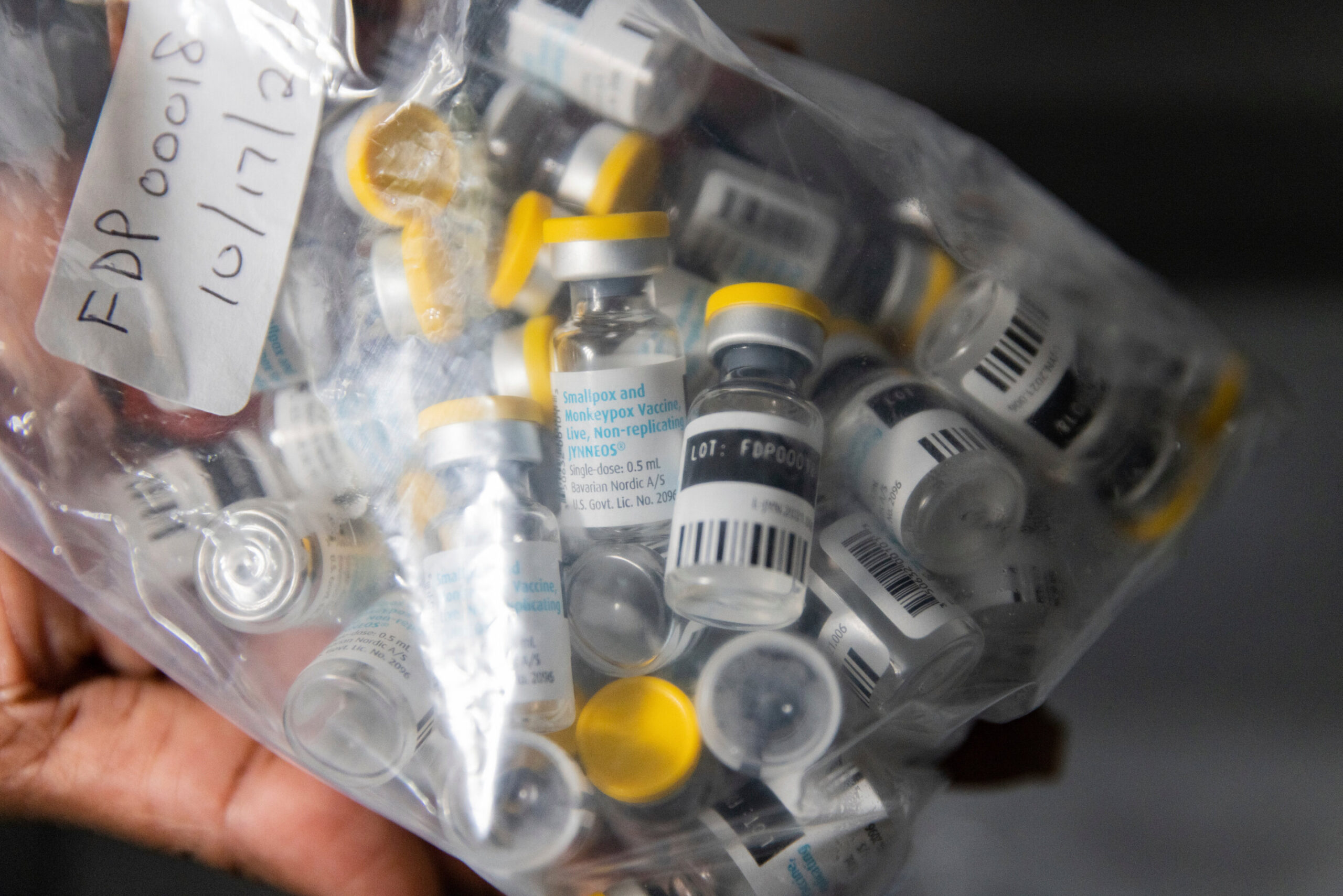 Kalifornijos mpox atvejai kelia susirūpinimą. Tačiau sveikatos apsaugos pareigūnai teigia, kad rizika išlieka maža