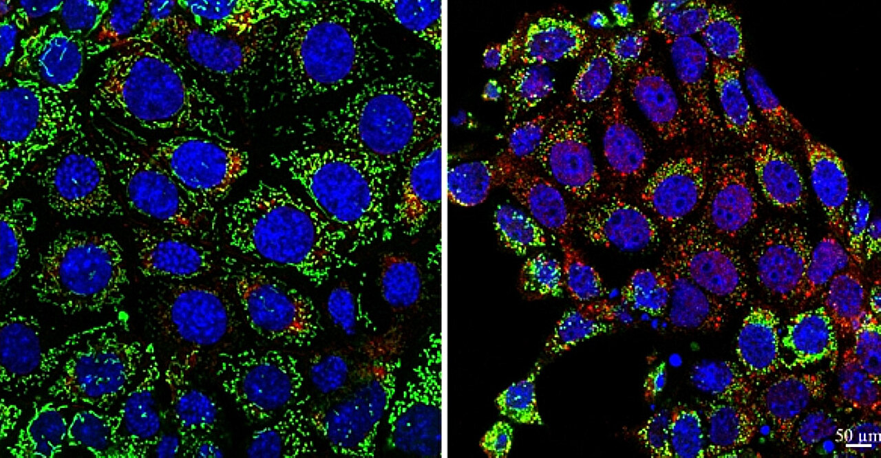 Mitochondrijų DNR mutacijos dėl inkstų streso veiksnių gali padėti numatyti būsimą organų nykimą