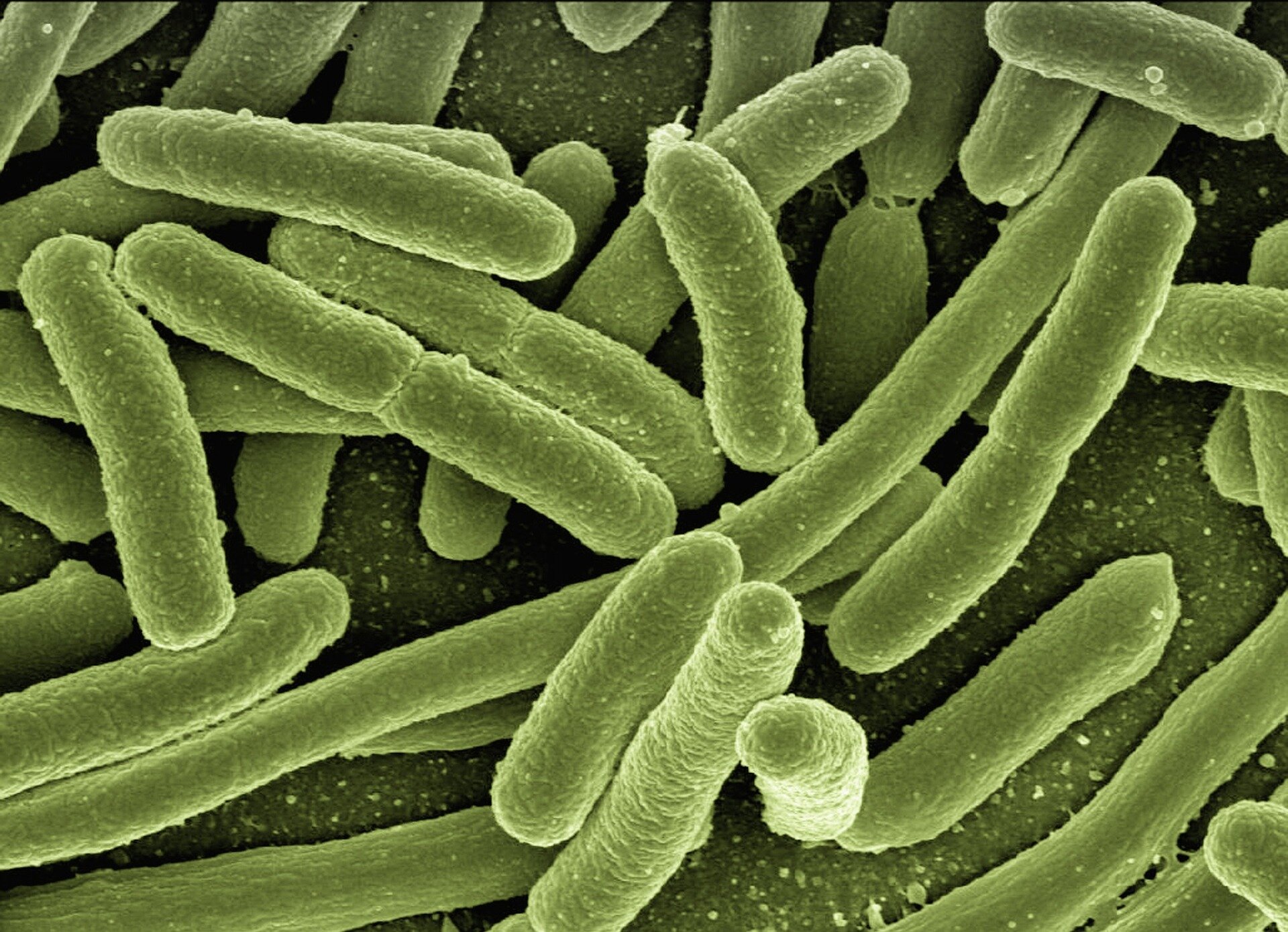 Pavojinga E. coli padermė blokuoja žarnyno gynybos mechanizmą nuo plintančios infekcijos