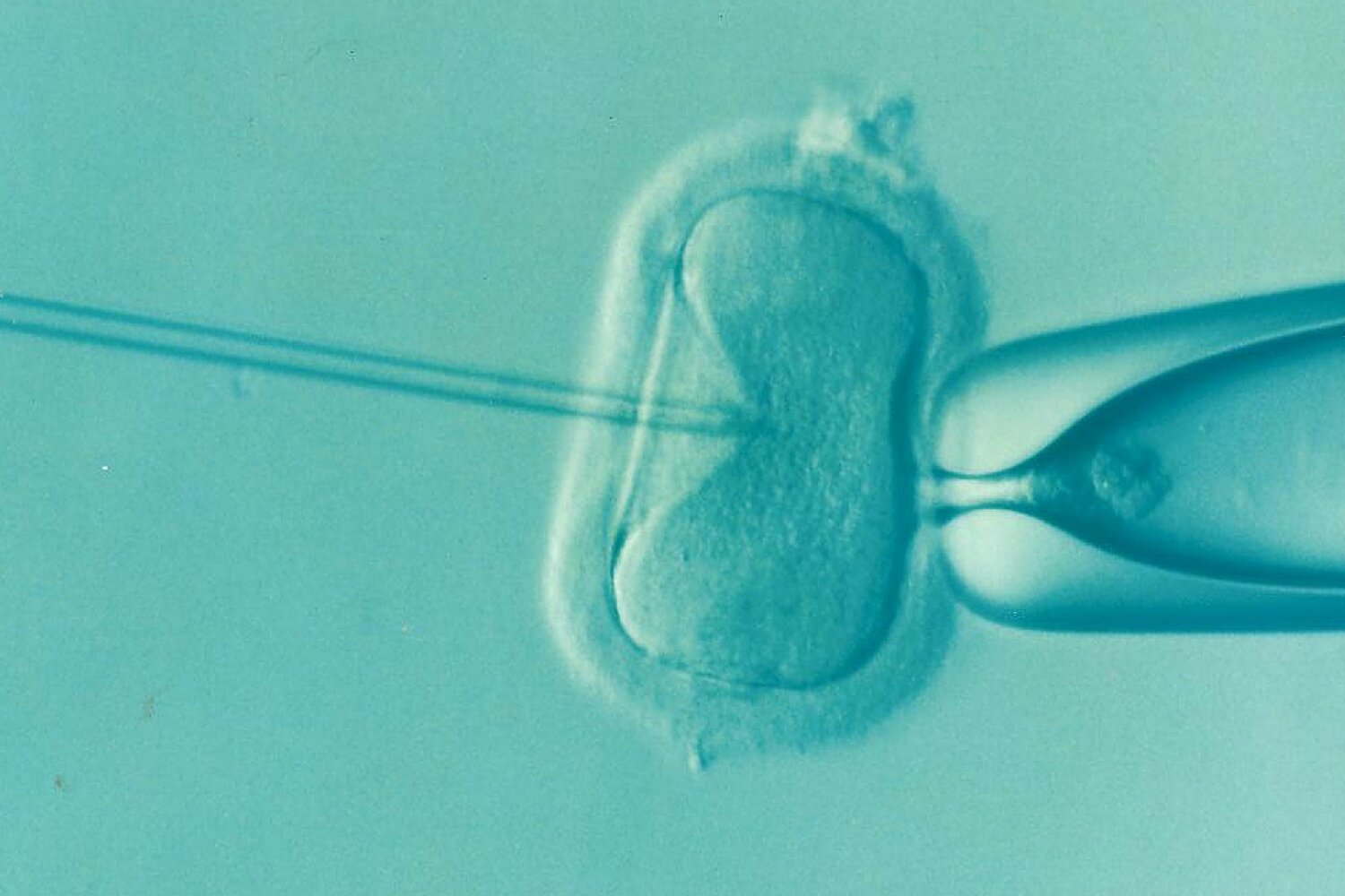 Didžiausias JK tyrimas rodo, kad donorų kiaušialąstės lemia daugiausiai IVF sėkmės moterims, vyresnėms nei 43 m