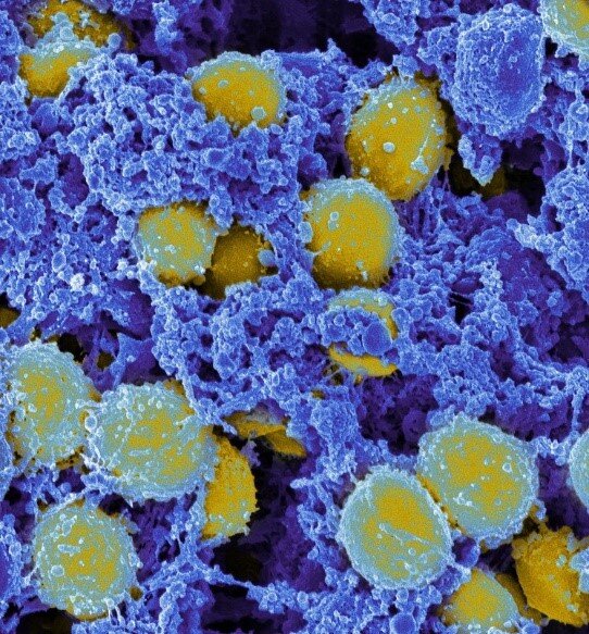 Klinikinis tyrimas rodo bakteriofagų terapijos veiksmingumą Staphylococcus aureus bakteriemijai