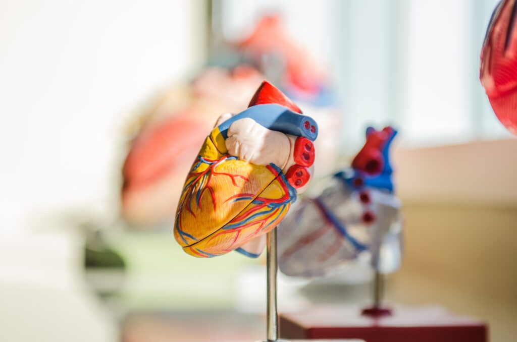 PCSK9, statinų derinys gali sumažinti cholesterolio kiekį po transplantacijos