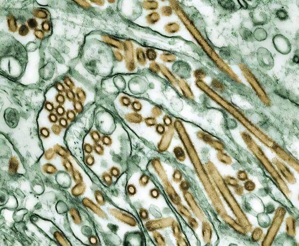 Žmonių H5N1 infekcija be simptomų: įrodymų vis dar nedaug