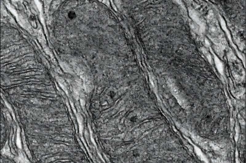 Naujas vaistas apsaugo mitochondrijas ir apsaugo nuo pelių inkstų pažeidimo