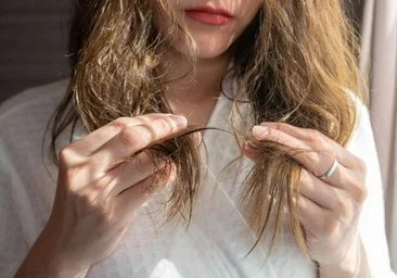 Telogen effluvium: kodėl rudenį padaugėja plaukų slinkimo ir kada nerimauti