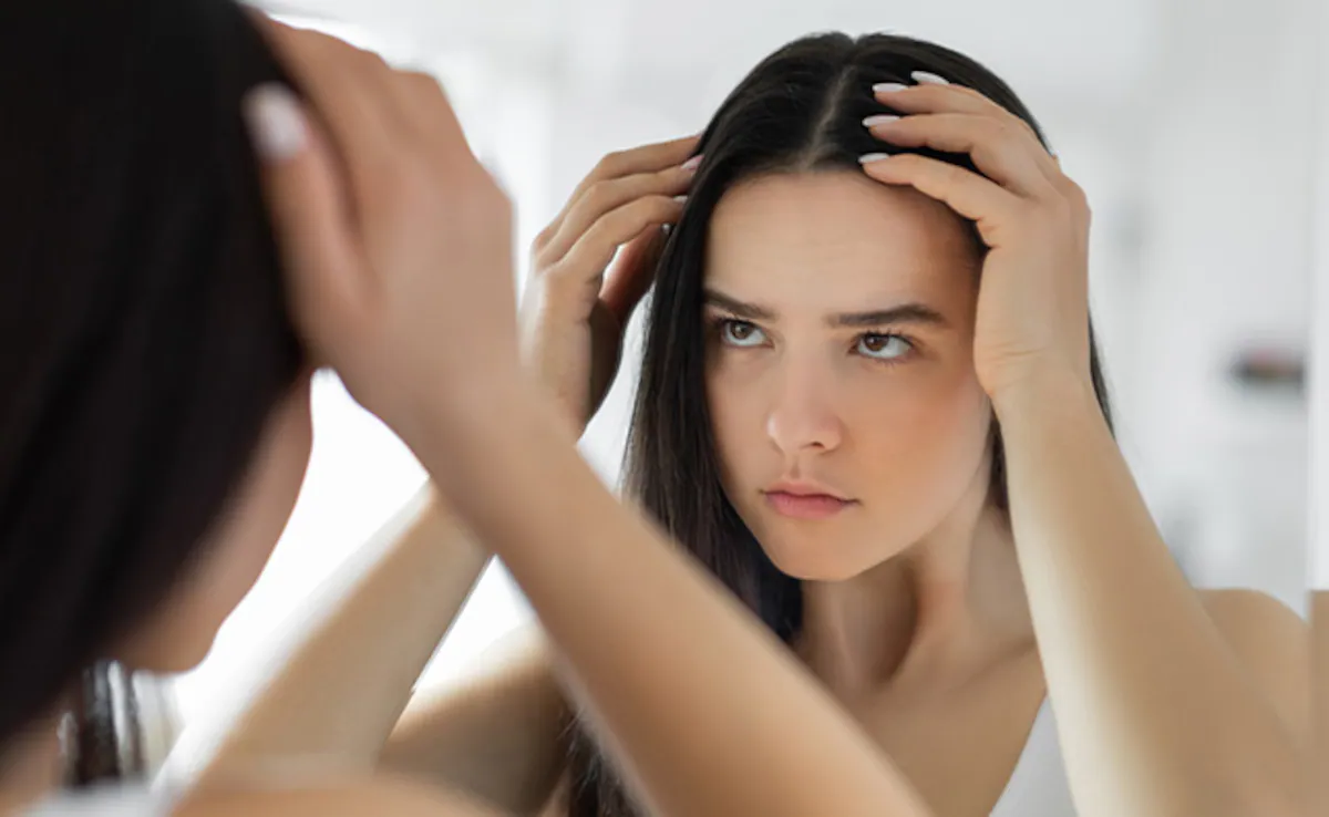 6 natūralios sveikatos problemos, padedančios kovoti su žiemos galvos odos išsausėjimu