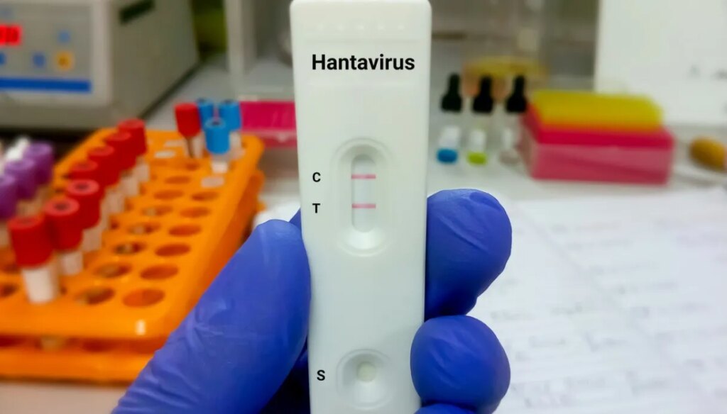Hantavirusas, kiek truks perspėjimas, atsargumo priemonės ir abejonės dėl besimptomių žmonių