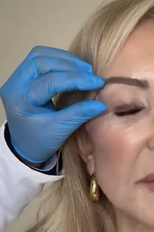 Carmen Lomana buvo atlikta blefaroplastika su Clínicas Diego de León.